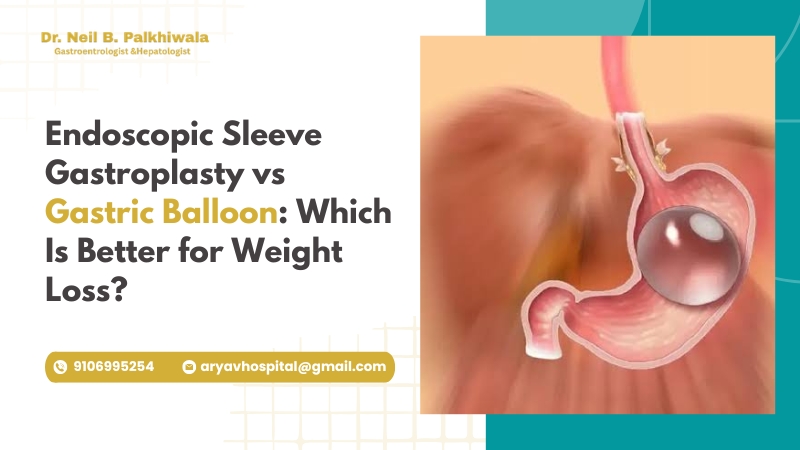 Gastric Balloon Vs Esg